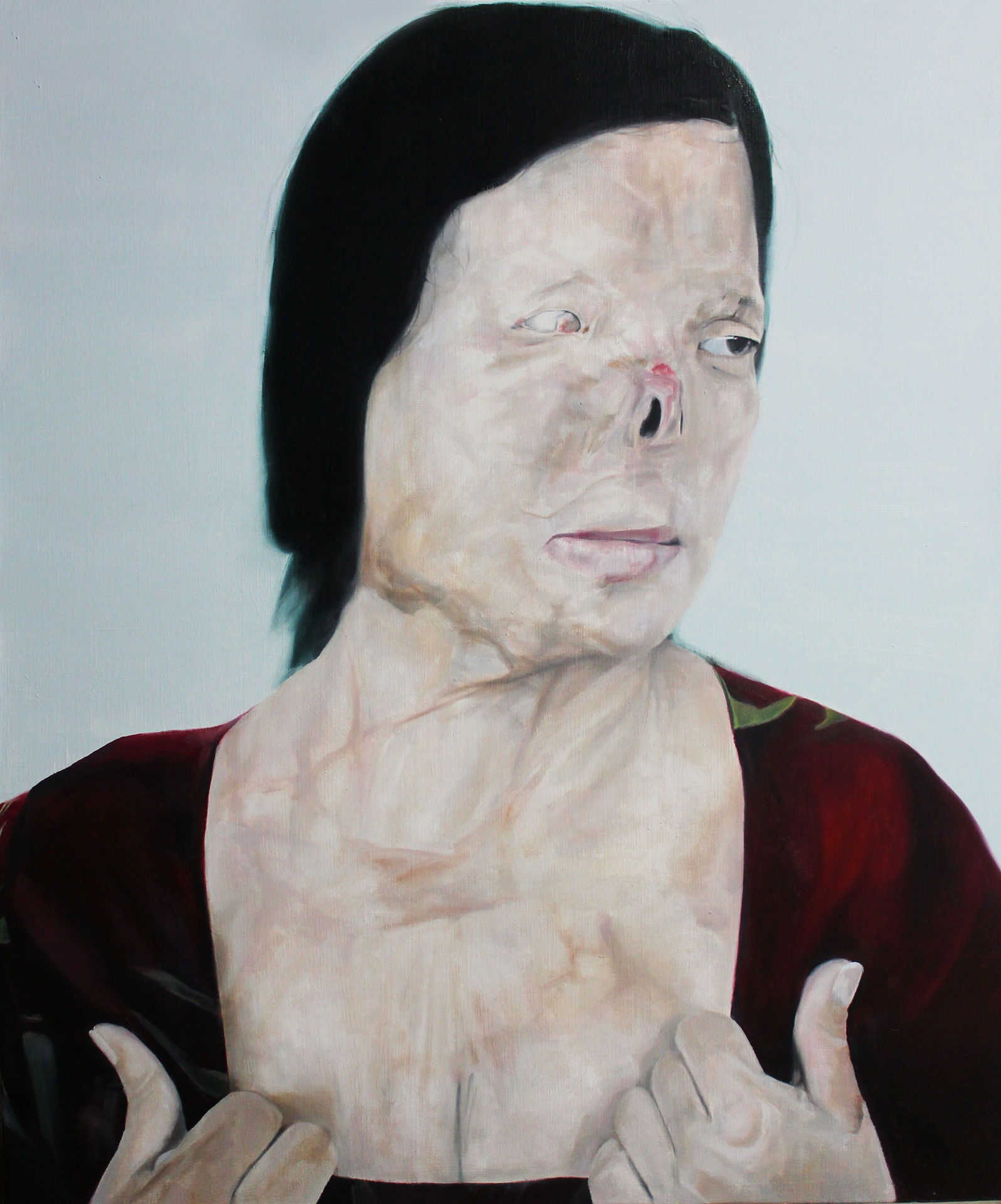 Acid Attack Victim (2)